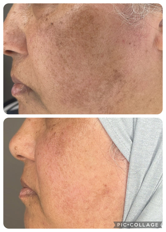 بكج التفتيح بالريتينول - إشراقة وتجديد لبشرتك