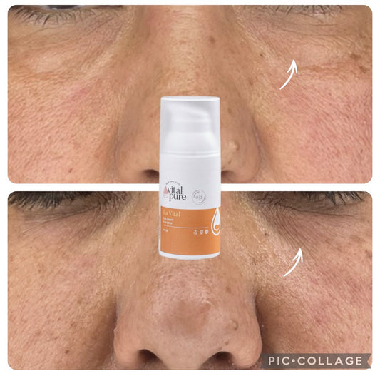 La vital eyes cream - كريم العينين